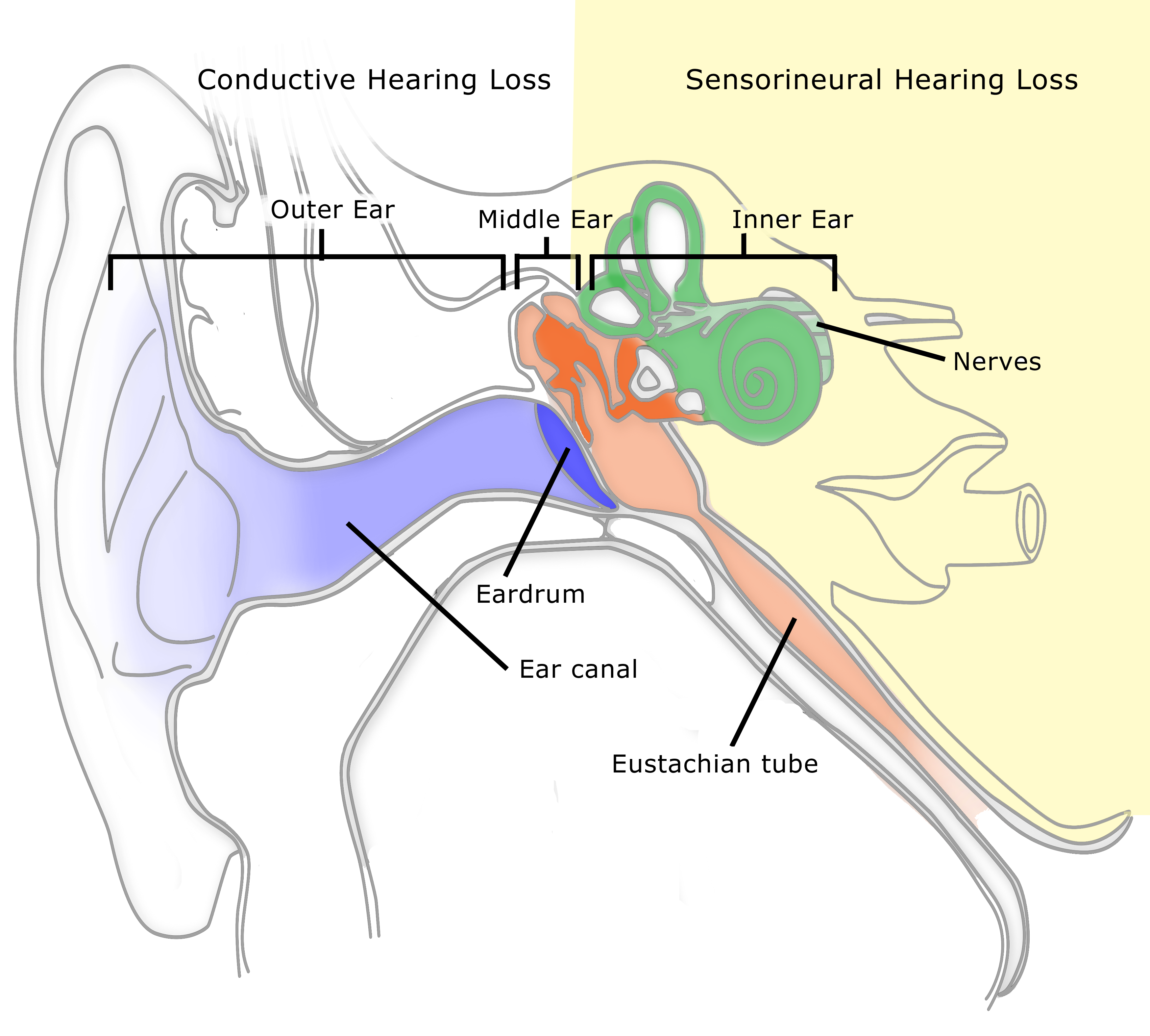 How to Read an Audiogram and Determine Degrees of Hearing Loss diagram ear right 